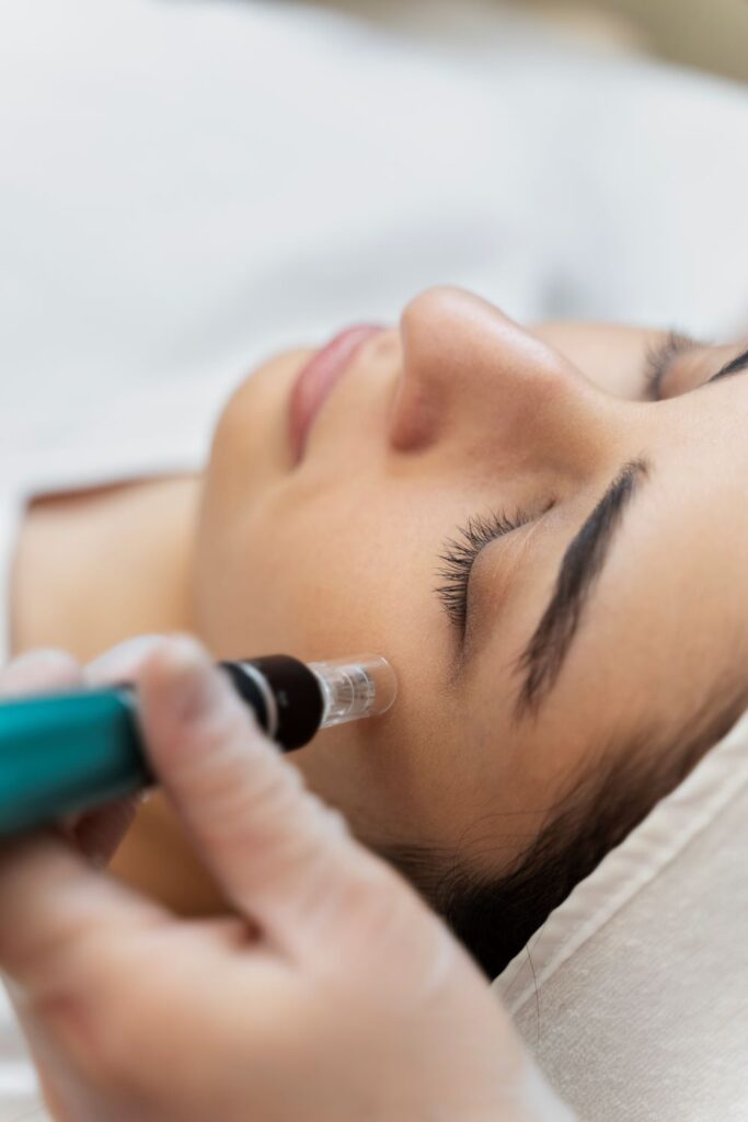 Skin needling