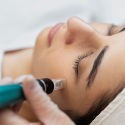Skin needling