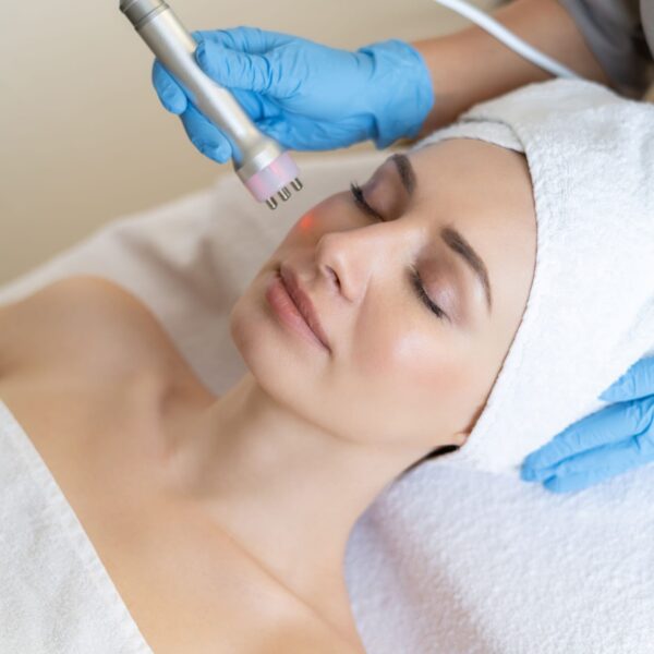 rf skin tightening