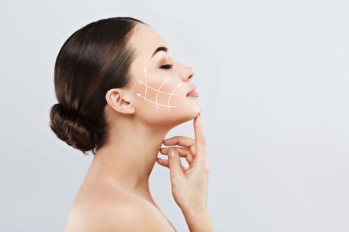 Hifu Full Face + RF Skin Tightening