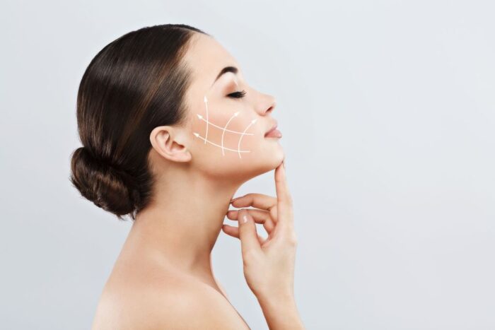 Hifu Full Face + RF Skin Tightening